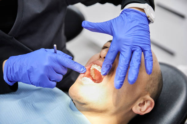 Best Emergency Dental Care for Broken or Chipped Teeth in Emigration Canyon, UT