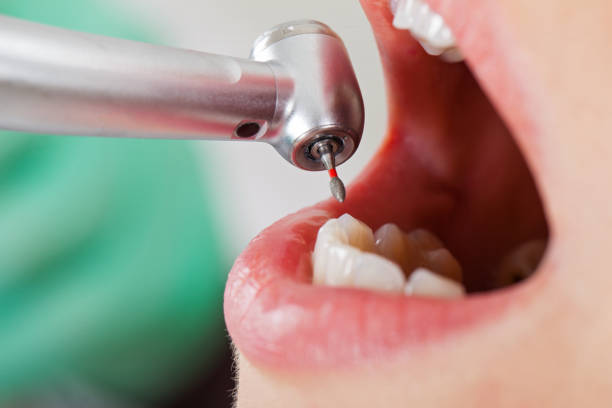 Best Emergency Gum Treatment in Emigration Canyon, UT